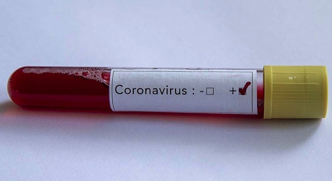 Çorum FK’da 3 kişide koronavirüs çıktı