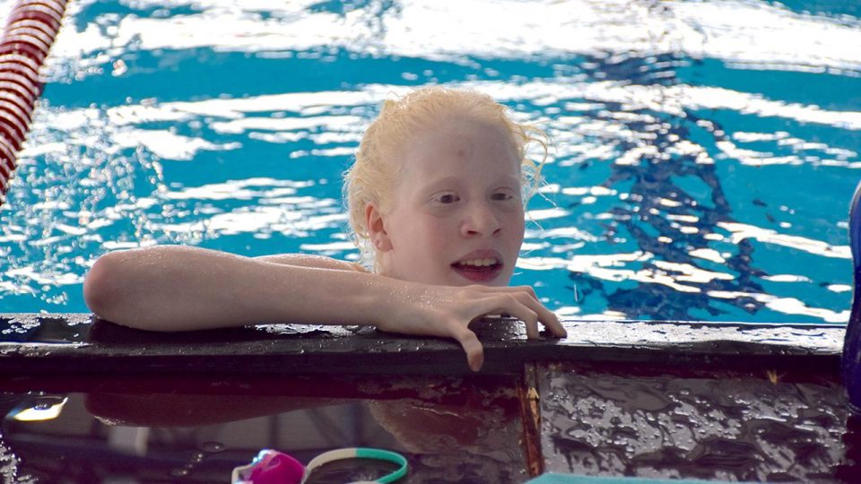 Albino yüzücü Ceren Yergezen’in hedefi Paralimpik Oyunları’na katılmak