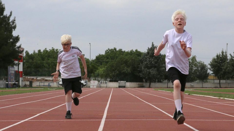 Şampiyon albino çocuklar atletizmde uluslararası başarılara odaklandı